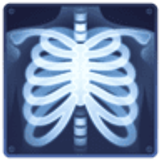 Röntgenfoto - Facebook